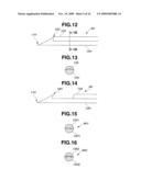 TREATMENT INSTRUMENT FOR ENDOSCOPE AND LYMPH NODE REMOVING METHOD diagram and image