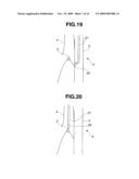 TREATMENT INSTRUMENT FOR ENDOSCOPE AND LYMPH NODE REMOVING METHOD diagram and image