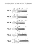 TREATMENT INSTRUMENT FOR ENDOSCOPE AND LYMPH NODE REMOVING METHOD diagram and image