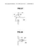 TREATMENT INSTRUMENT FOR ENDOSCOPE AND LYMPH NODE REMOVING METHOD diagram and image