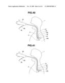 TREATMENT INSTRUMENT FOR ENDOSCOPE AND LYMPH NODE REMOVING METHOD diagram and image