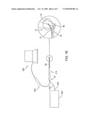 SUBMUCOSAL FIBROID ABLATION FOR THE TREATMENT OF MENORRHAGIA diagram and image