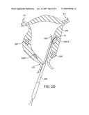 SUBMUCOSAL FIBROID ABLATION FOR THE TREATMENT OF MENORRHAGIA diagram and image