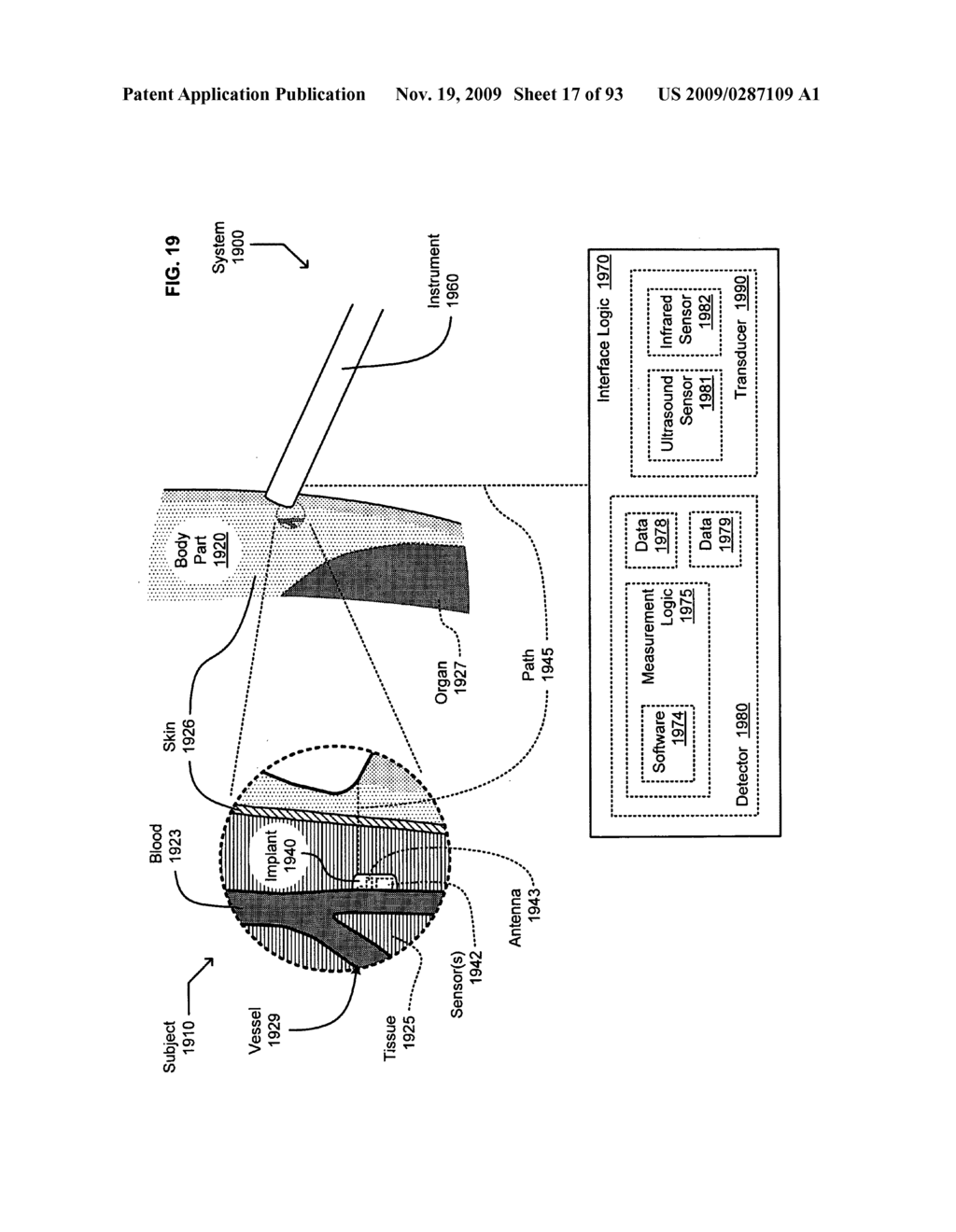 Circulatory monitoring systems and methods - diagram, schematic, and image 18