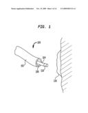 BIOPSY DEVICE diagram and image