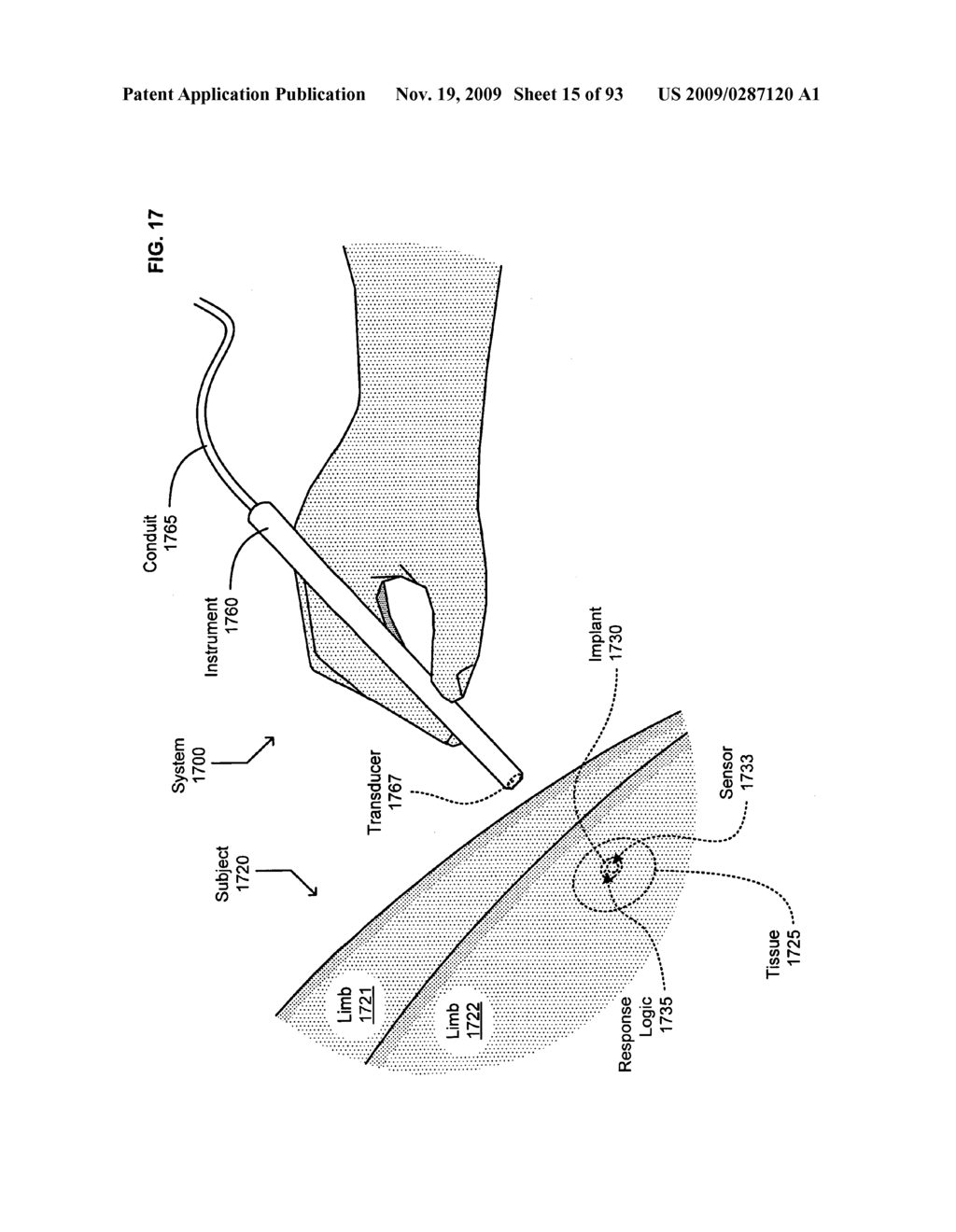 Circulatory monitoring systems and methods - diagram, schematic, and image 16