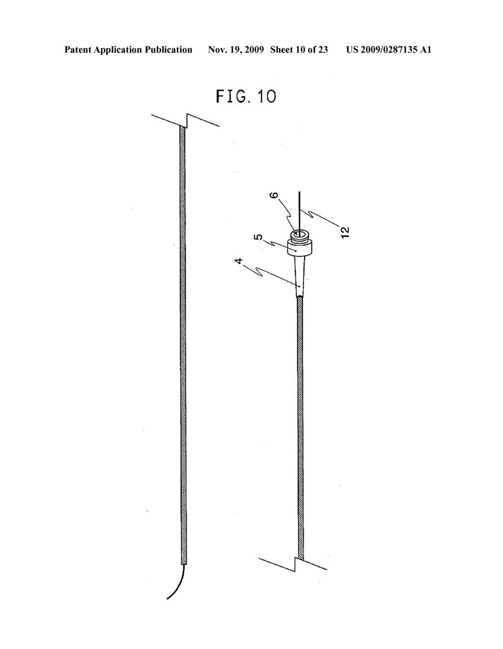 Catheter - diagram, schematic, and image 11