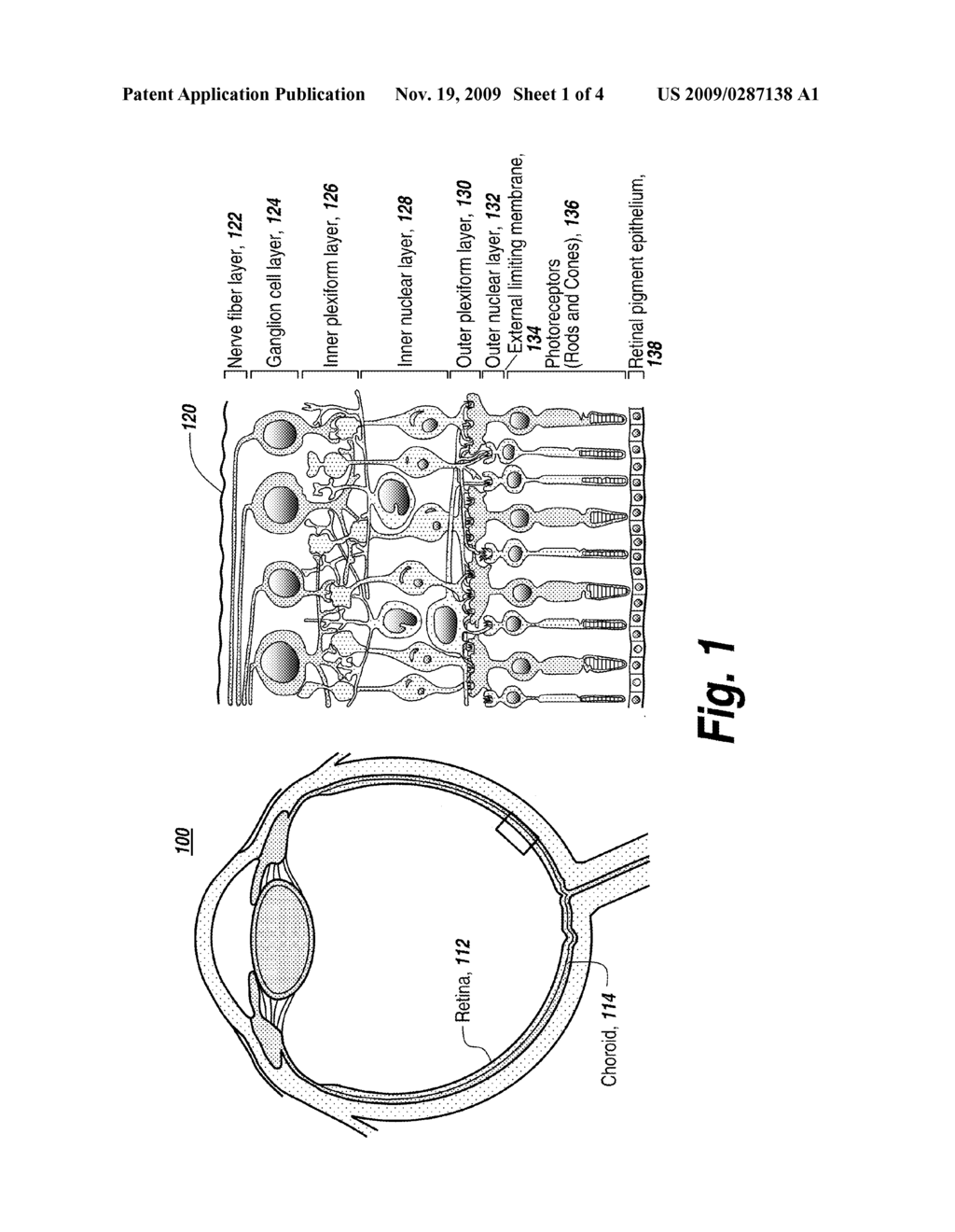 LASER ASSISTED THERAPEUTIC AGENT DELIVERY INTO A TARGETED TISSUE - diagram, schematic, and image 02