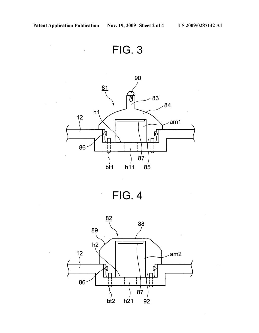 ULTRASONIC TREATMENT APPARATUS - diagram, schematic, and image 03