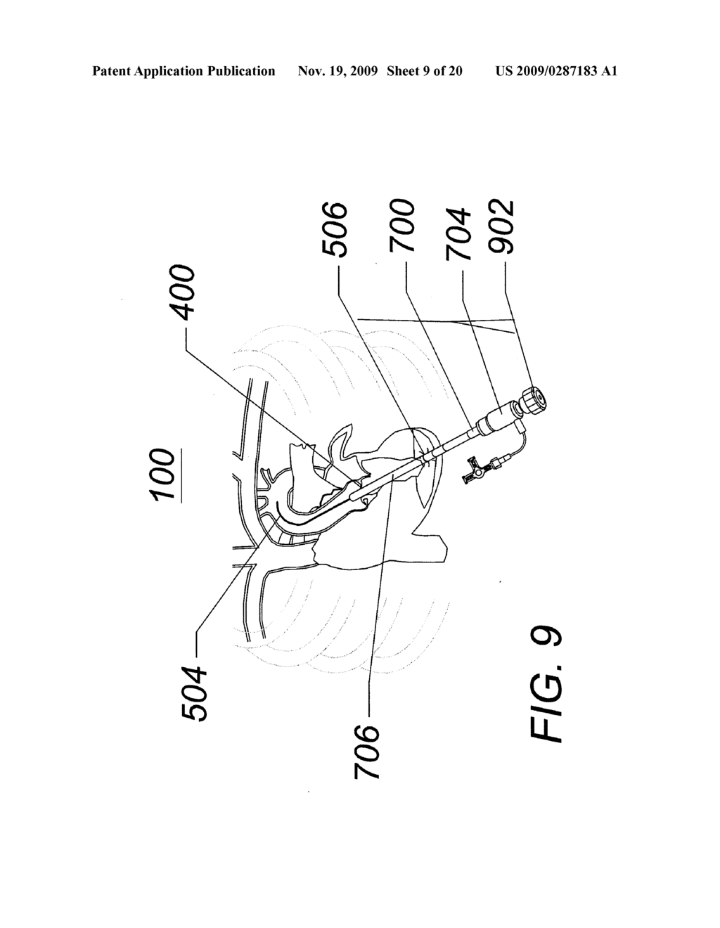 EXPANDABLE TRANSAPICAL SHEATH AND METHOD OF USE - diagram, schematic, and image 10