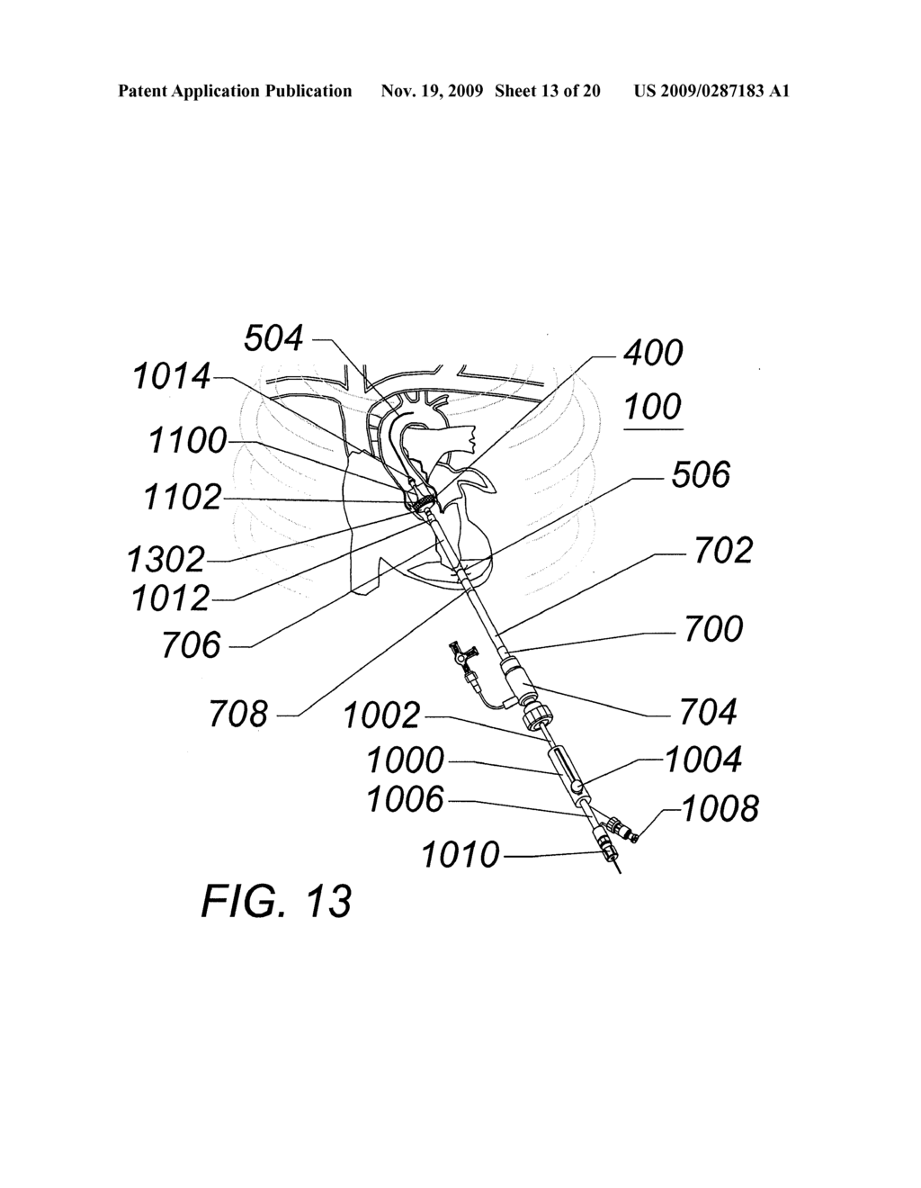 EXPANDABLE TRANSAPICAL SHEATH AND METHOD OF USE - diagram, schematic, and image 14