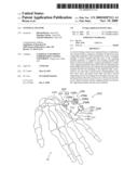 EXTERNAL FIXATOR diagram and image