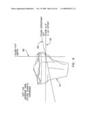 Method and apparatus for performing an open wedge, high tibial osteotomy diagram and image