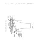 Method and apparatus for performing an open wedge, high tibial osteotomy diagram and image