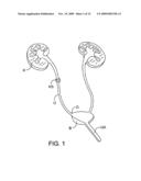 METHODS AND APPARATUS FOR DEPLOYING SHORT LENGTH URETERAL STENTS diagram and image