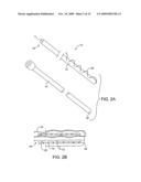 METHODS AND APPARATUS FOR DEPLOYING SHORT LENGTH URETERAL STENTS diagram and image