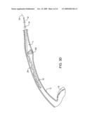 METHODS AND APPARATUS FOR DEPLOYING SHORT LENGTH URETERAL STENTS diagram and image