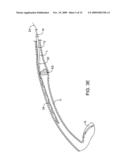 METHODS AND APPARATUS FOR DEPLOYING SHORT LENGTH URETERAL STENTS diagram and image