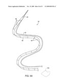 METHODS AND APPARATUS FOR DEPLOYING SHORT LENGTH URETERAL STENTS diagram and image