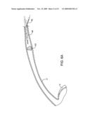 METHODS AND APPARATUS FOR DEPLOYING SHORT LENGTH URETERAL STENTS diagram and image