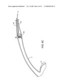 METHODS AND APPARATUS FOR DEPLOYING SHORT LENGTH URETERAL STENTS diagram and image