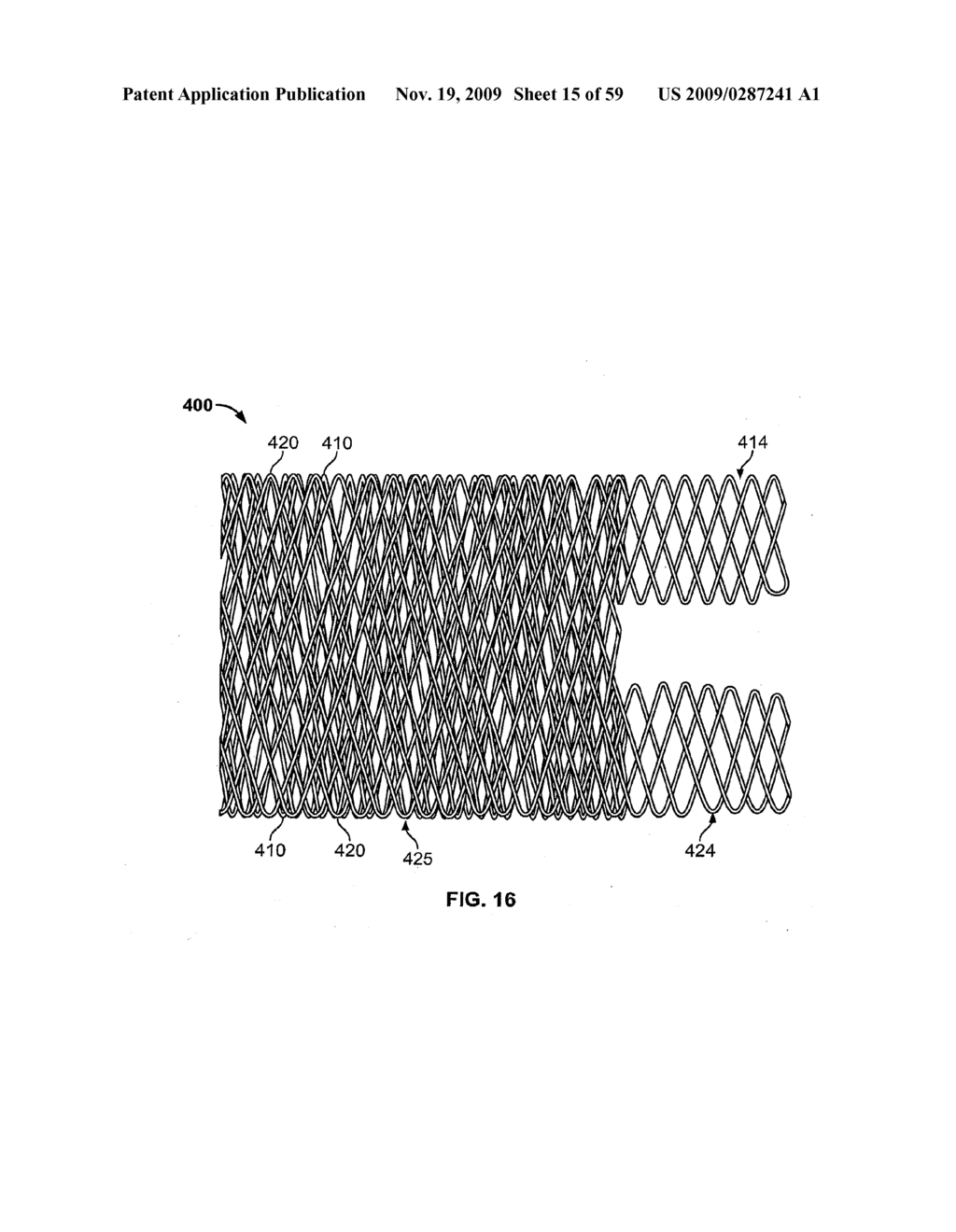 METHODS AND APPARATUS FOR LUMINAL STENTING - diagram, schematic, and image 16