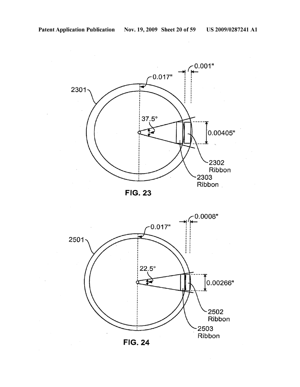 METHODS AND APPARATUS FOR LUMINAL STENTING - diagram, schematic, and image 21