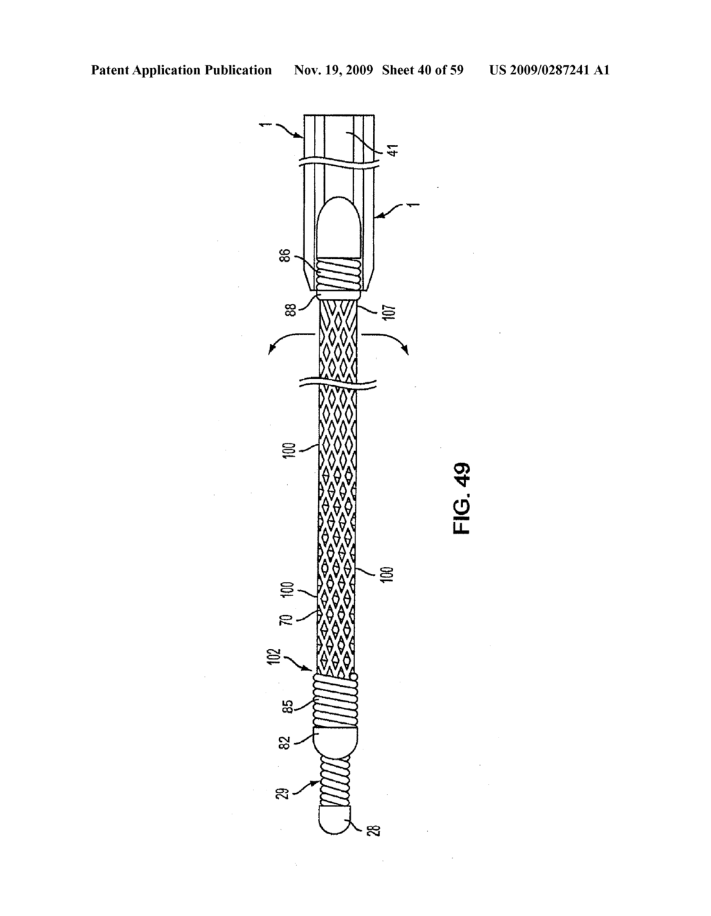 METHODS AND APPARATUS FOR LUMINAL STENTING - diagram, schematic, and image 41