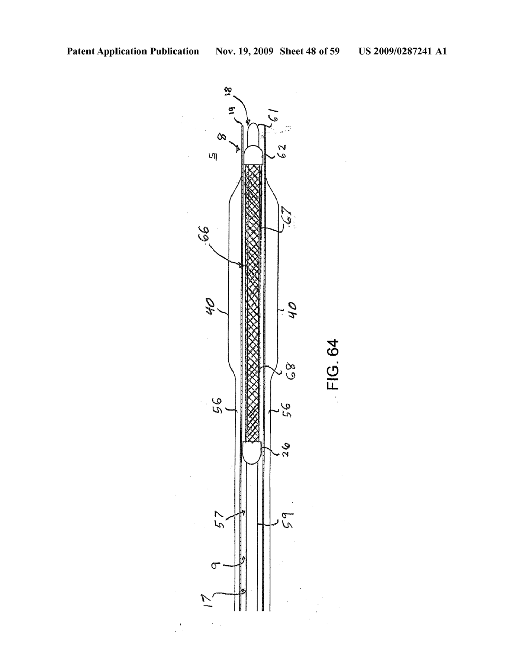 METHODS AND APPARATUS FOR LUMINAL STENTING - diagram, schematic, and image 49