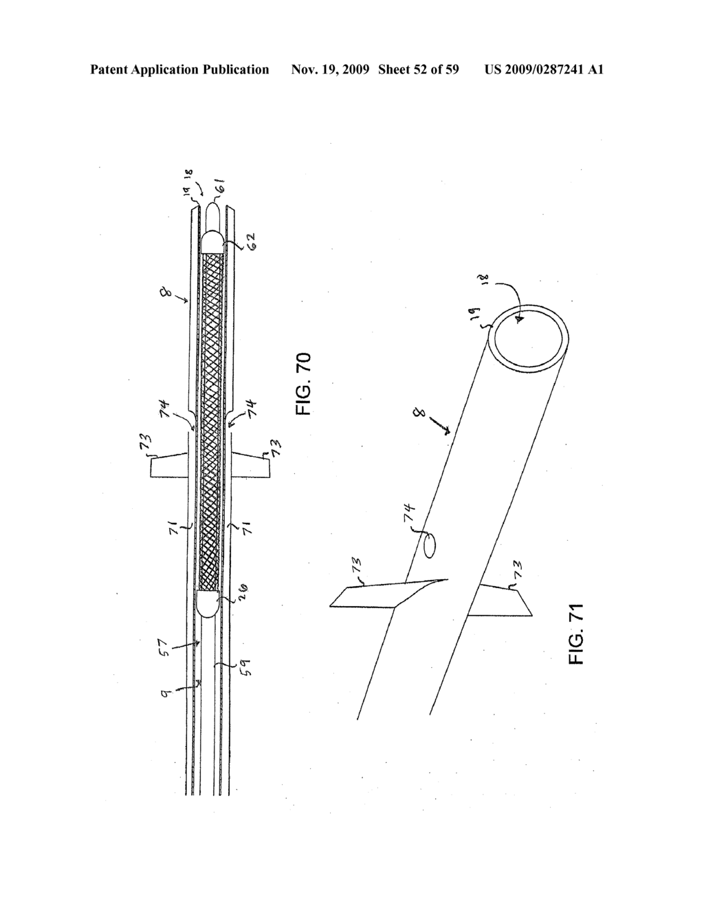 METHODS AND APPARATUS FOR LUMINAL STENTING - diagram, schematic, and image 53