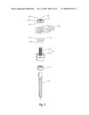 POLYAXIAL SCREW SYSTEM diagram and image