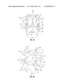 Method for accessing a spinal facet joint diagram and image