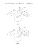 Method for accessing a spinal facet joint diagram and image