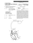 METHODS AND SYSTEMS FOR IMPROVED ARRHYTHMIA DISCRIMINATION diagram and image