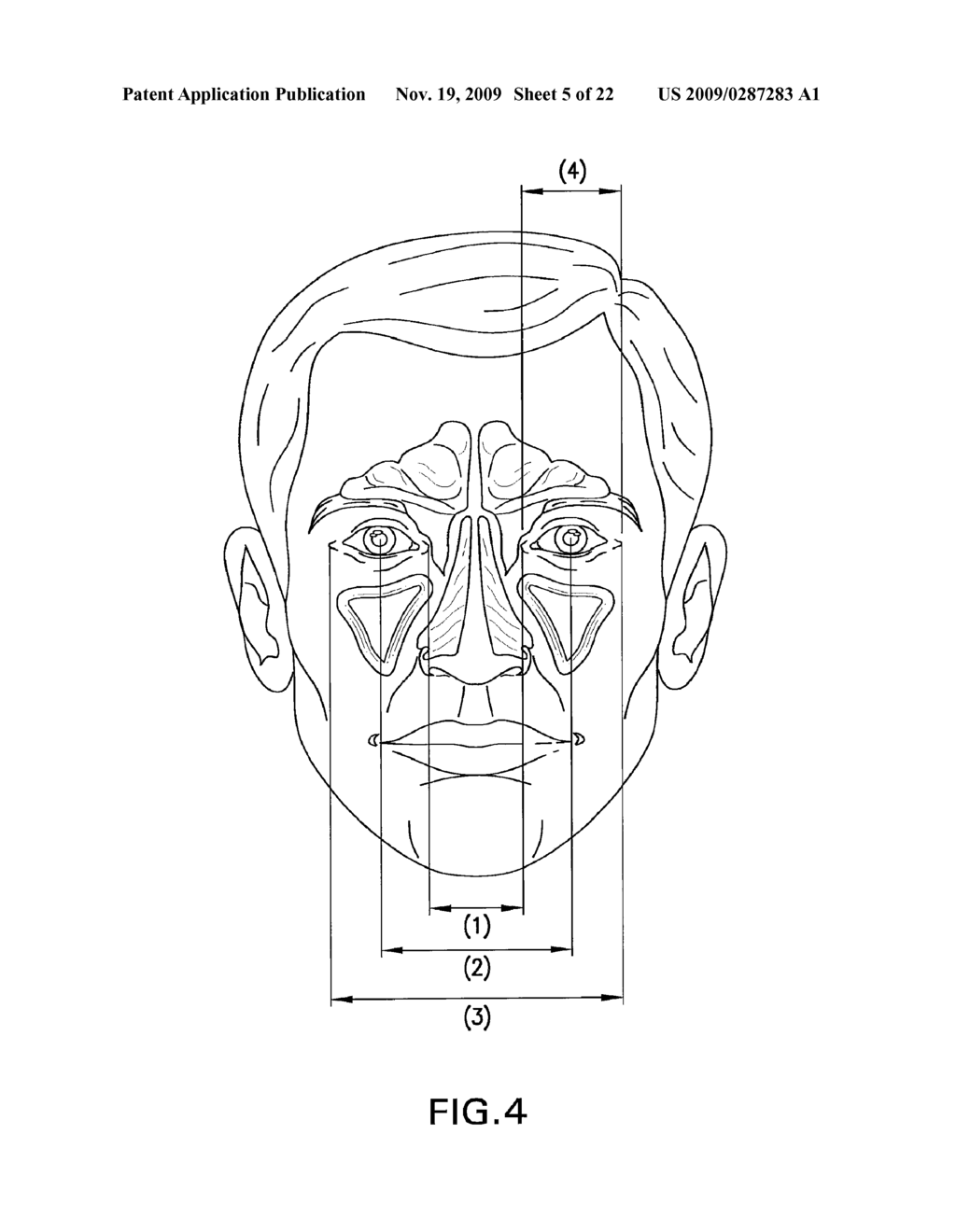 Thermal compress assembly and system with external frame - diagram, schematic, and image 06