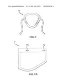 Thermal compress assembly and system with external frame diagram and image