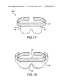 Thermal compress assembly and system with external frame diagram and image