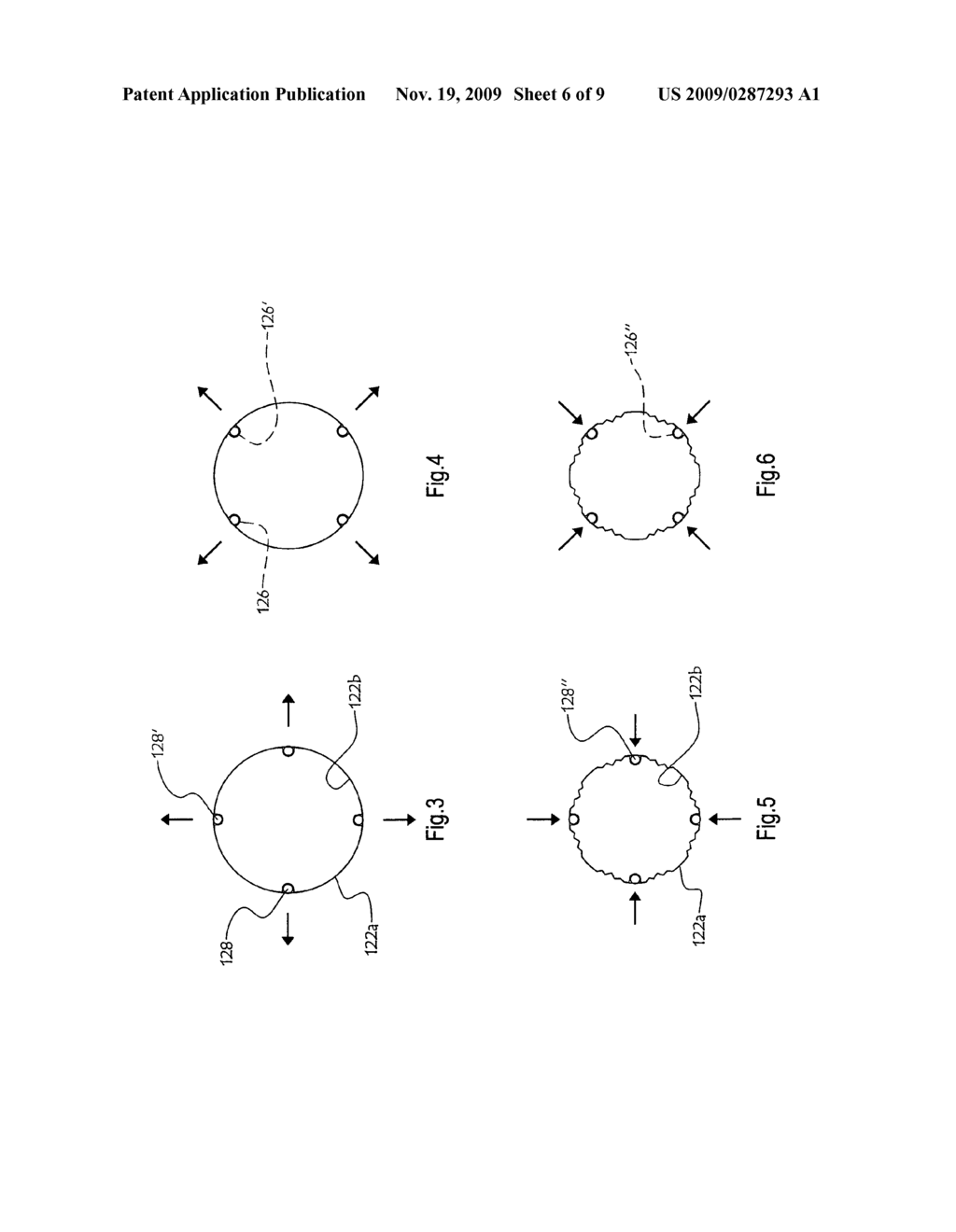 MAGNETICALLY INDUCED RADIAL EXPANSION VASCULAR STENT - diagram, schematic, and image 07