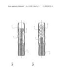 MAGNETICALLY INDUCED RADIAL EXPANSION VASCULAR STENT diagram and image