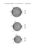 Braid-Ball Embolic Devices diagram and image