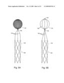 Braid-Ball Embolic Devices diagram and image