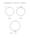 Braid-Ball Embolic Devices diagram and image