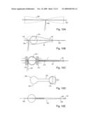 Braid-Ball Embolic Devices diagram and image