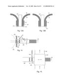 Braid-Ball Embolic Devices diagram and image