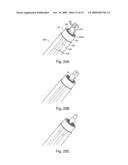 Braid-Ball Embolic Devices diagram and image