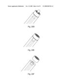 Braid-Ball Embolic Devices diagram and image