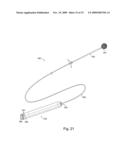 Braid-Ball Embolic Devices diagram and image