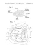 PHYSIOLOGICALLY HARMONIZED TRICUSPID ANNULOPLASTY RING diagram and image