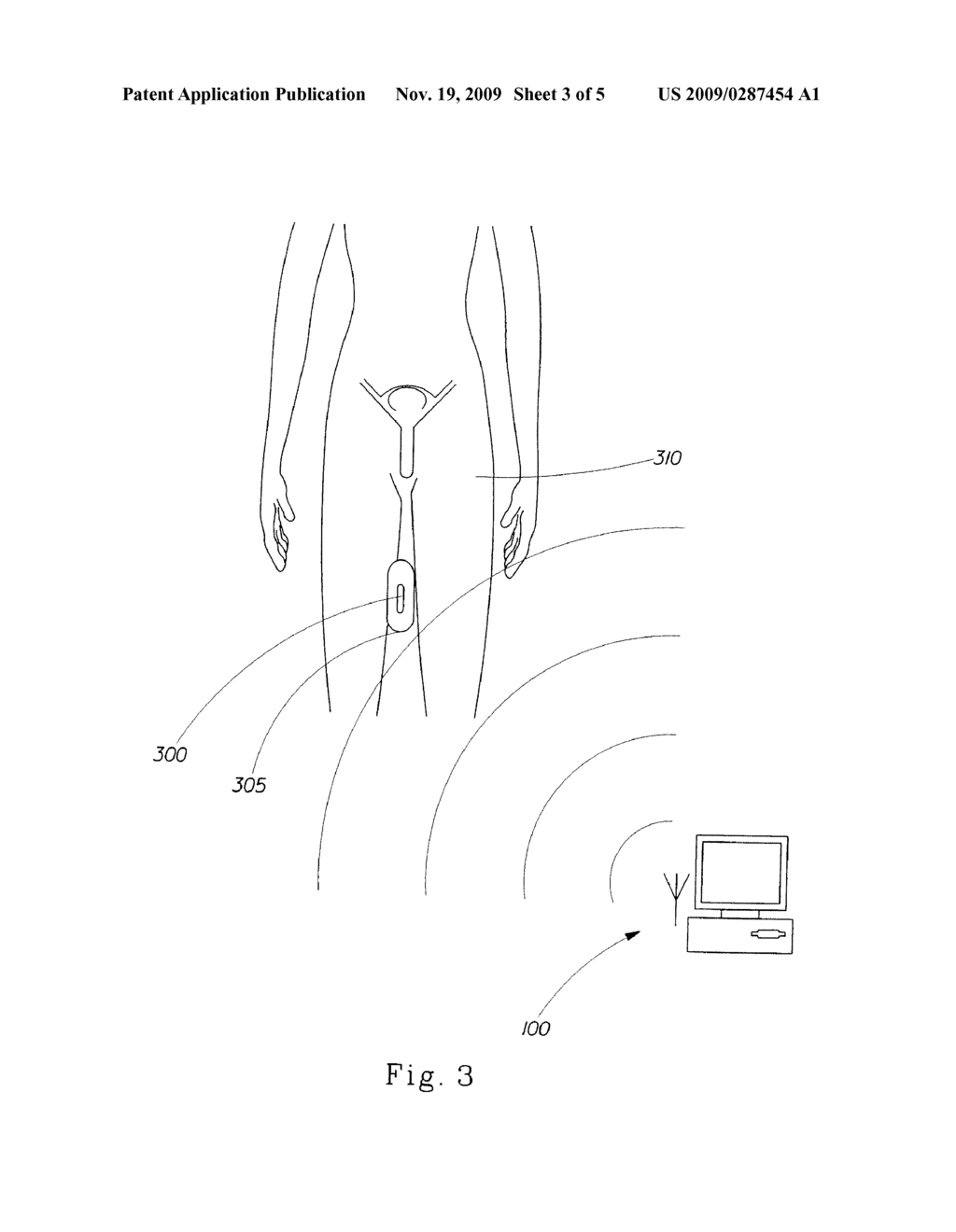 METHOD OF DETERMINING THE DYNAMIC LOCATION OF A PROTECTION DEVICE - diagram, schematic, and image 04