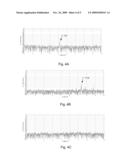 Optical Coherence Tomography Laser with Integrated Clock diagram and image